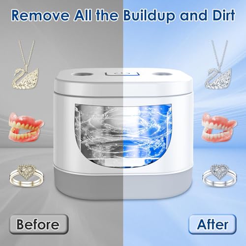 Ultrasonic Retainer Cleaner with UV Light for Invisalign and More 45kHz Cleaning Pod