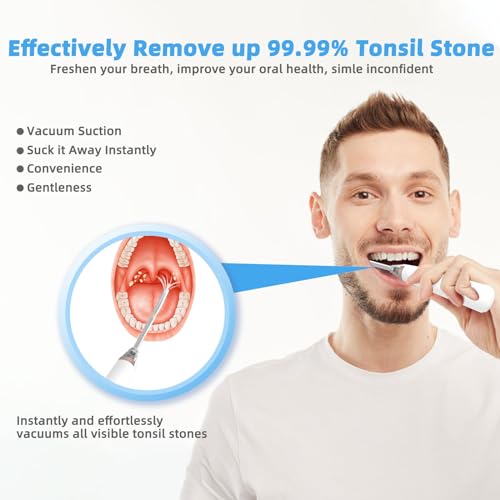Easy-to-use Voraiya Electronic Tonsil Stone Remover Vacuum - Ideal for Mouth Cleaning & Fresher Breath