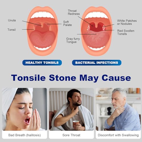 Painless Electric Tonsil Stone Remover with LED Light