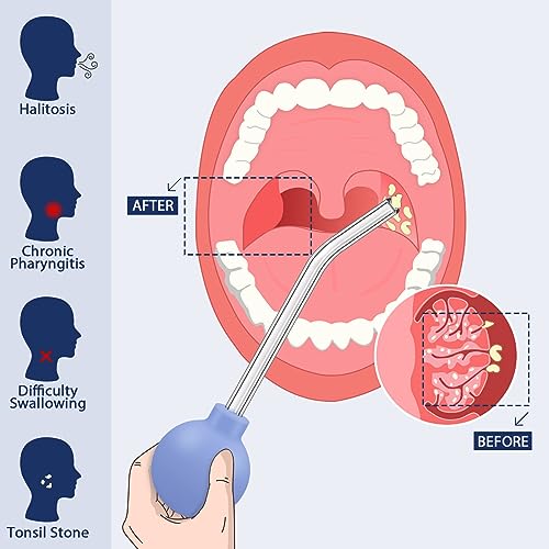 Kids & Adult Tonsil Stone Removal Kit