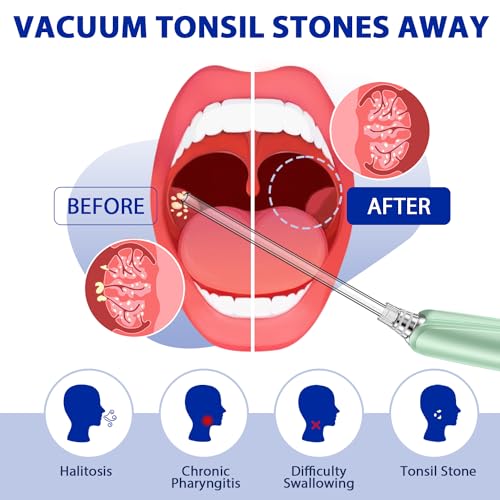 Updated: Tonsil Stone Removal Kit with Vacuum, LED Light, and Water Flosser