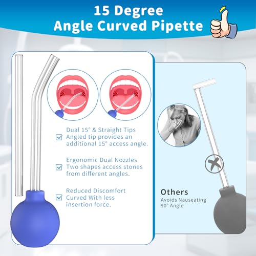 Tonsil Stone Removal Kit: Easy and Effective Solution for Removing Tonsil Stones (Audience: People with Tonsil Stones)
