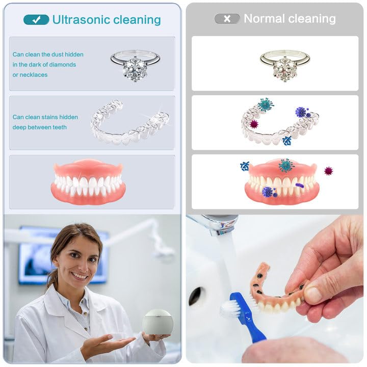 Denture and Jewelry Ultrasonic Cleaner with 5 Minute Automatic Timed Shutdown