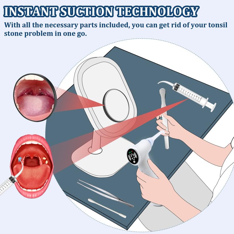 LED Tonsil Stone Removal Kit for Easy Cleaning at Home